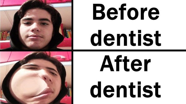 dentist before and after meme