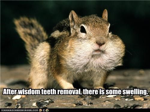 18 Wisdom Teeth Memes That Are Too Funny For Words | SayingImages.com