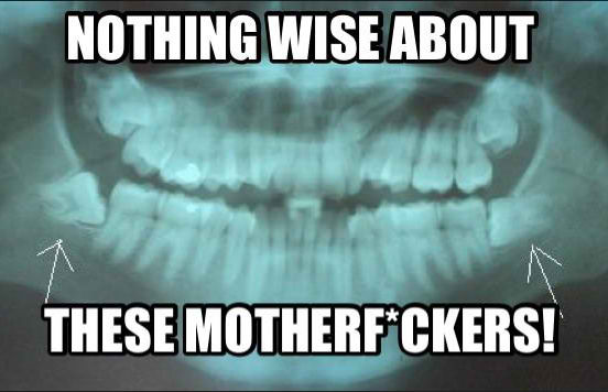 25-wisdom-teeth-memes-that-are-too-funny-for-words-sayingimages